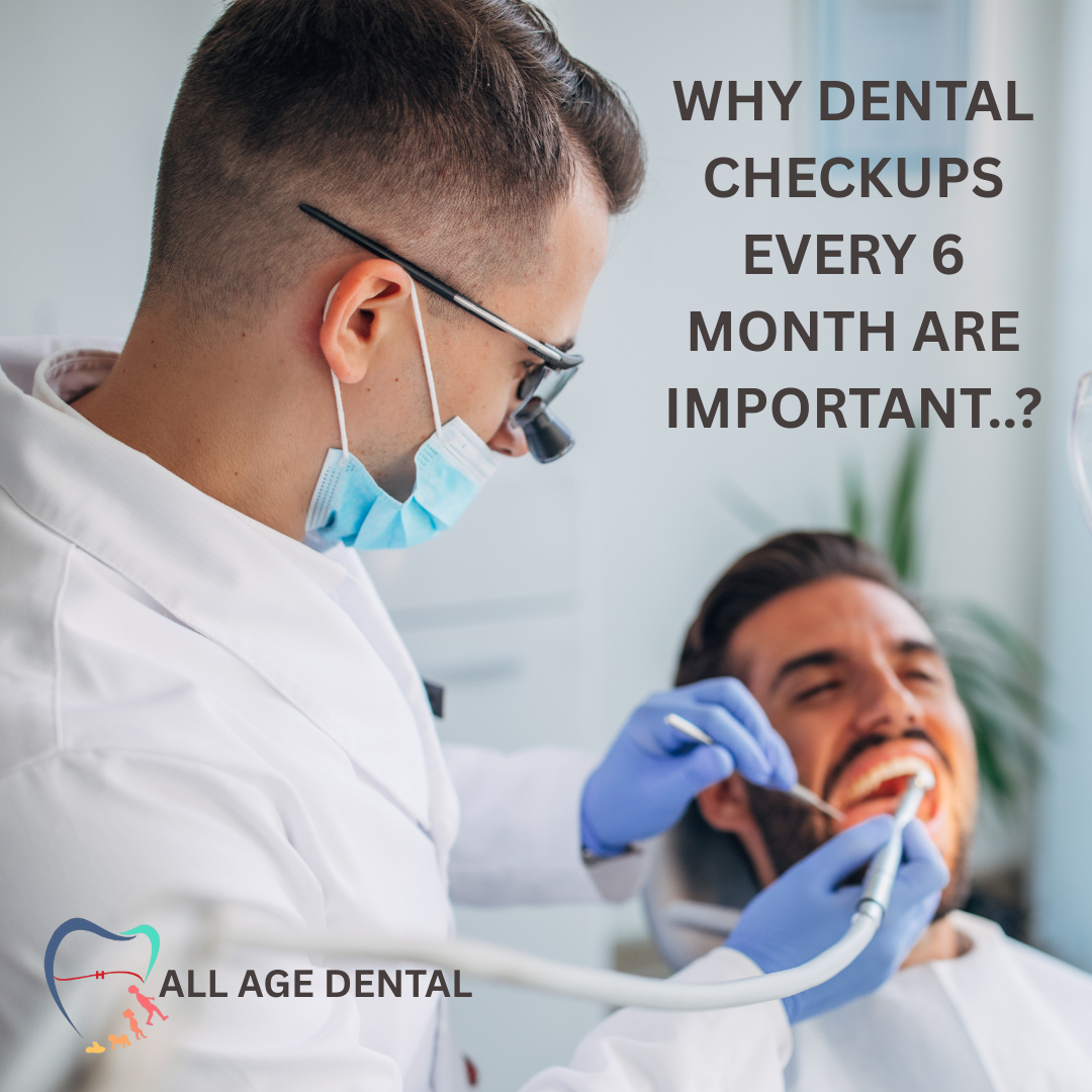 Why Dental Checkups Every 6 Months Are Important.?